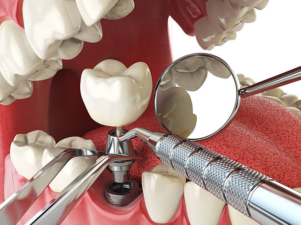 Professional Emergency Dentist in SD