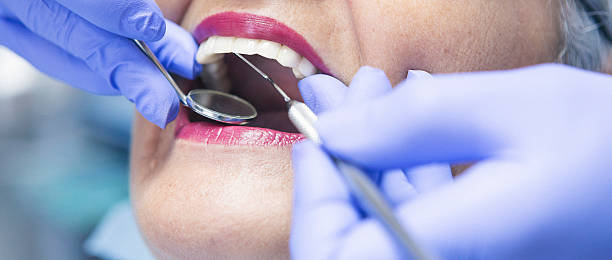Best Root Canal Emergency Dentist  in Mission, SD