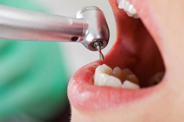 Best Tooth Infection Emergency Dentist  in Mission, SD